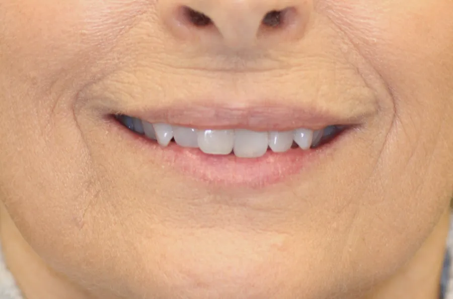 Before treatment: E. B.