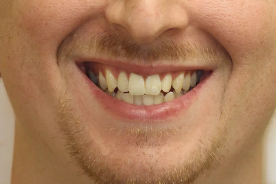 Before treatment: E. M.